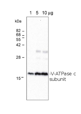 western blot detection using anti-V-ATPase c subunit antibodies 